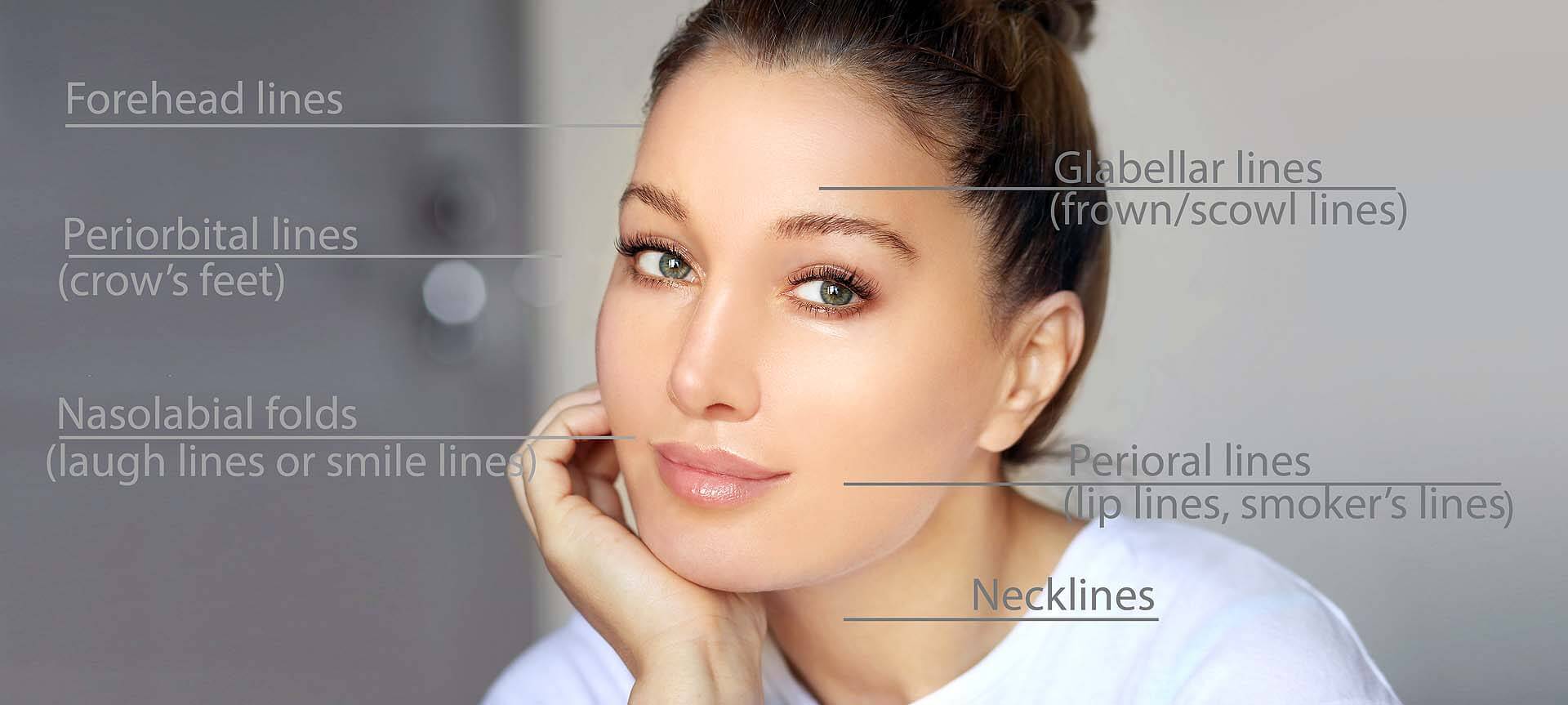 Profhilo Injections Lucy Foster Aesthetics