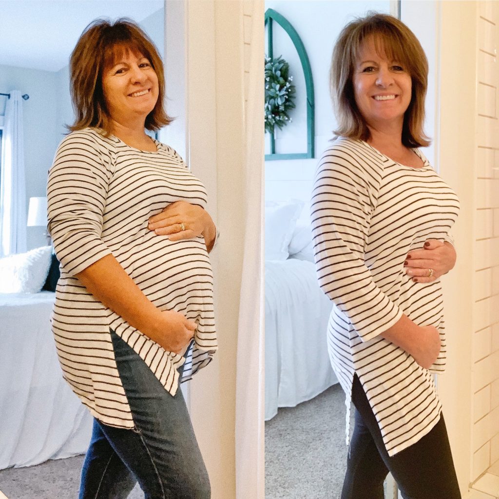 My Weight Loss Before and After Journey Lyndale Drive