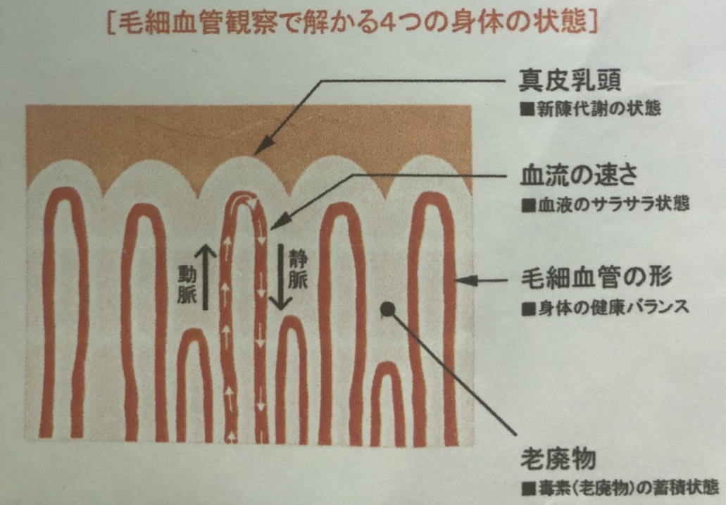 【毛細血管観察装置】とは！？ スーパースカルプ発毛センター 大津膳所店