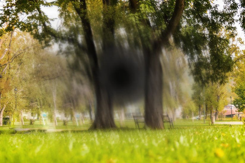 Macular Degeneration Niles Macular Degeneration Treatment