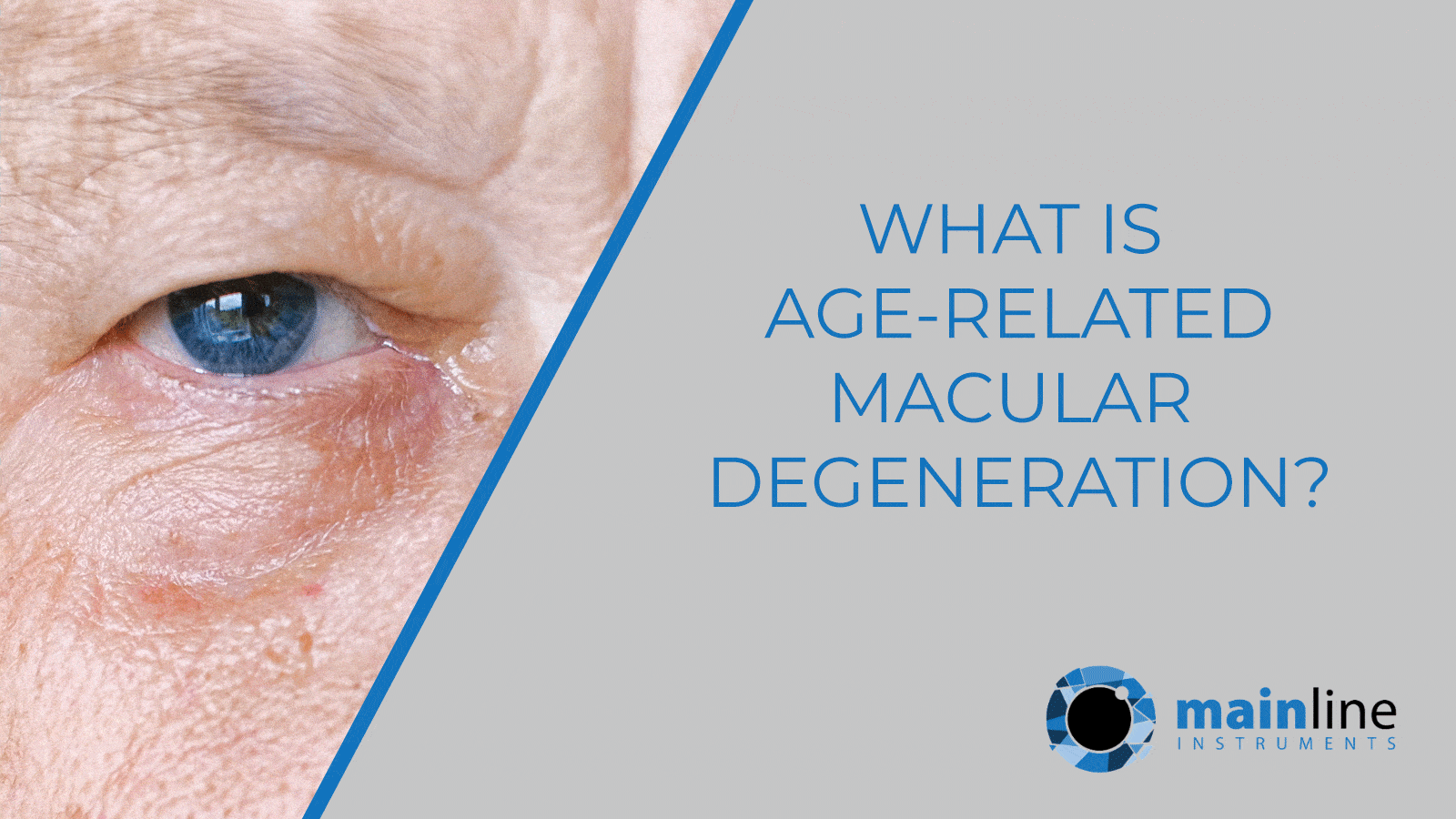 What is agerelated macular degeneration? News Mainline Instruments