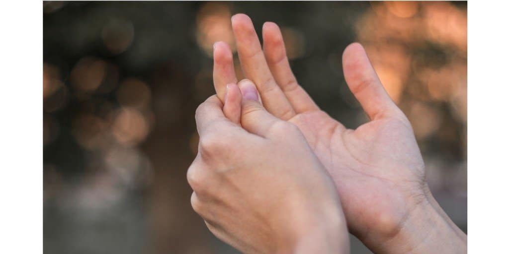 Discoid Lupus And Fluorescent Lighting Shelly Lighting