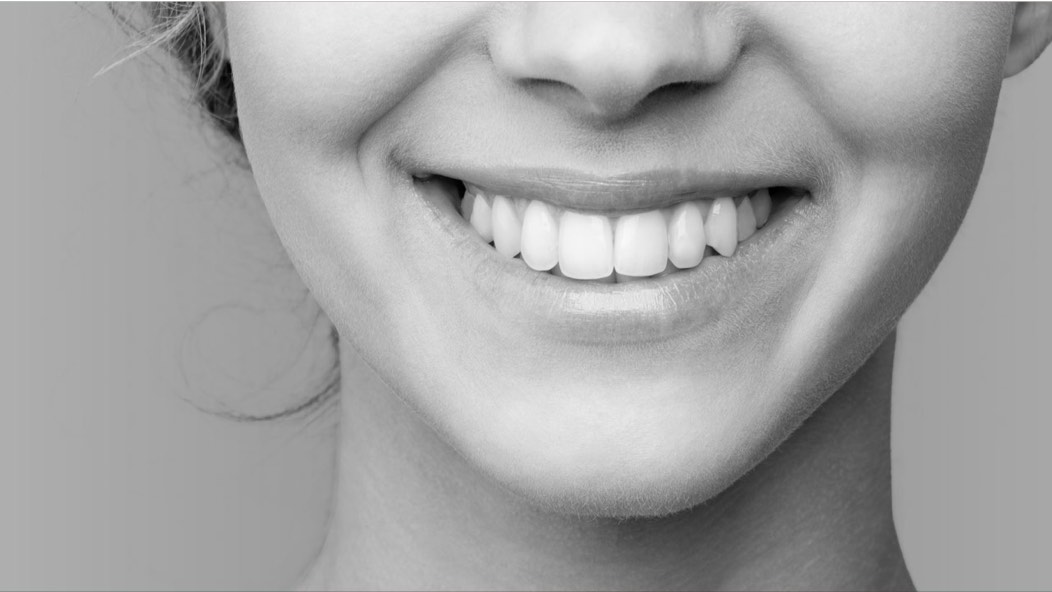 Heat cure acrylic resin Makevale