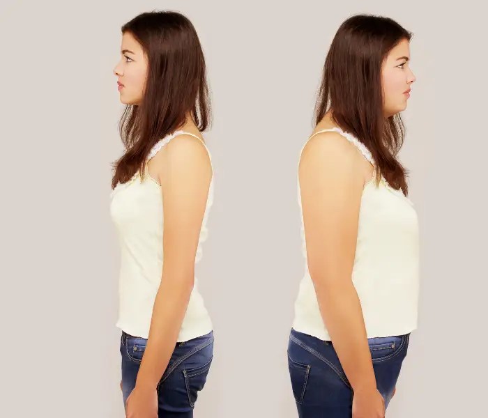 Body Dysmorphia Weight Loss How To Know If You Have Body Dysmorphia