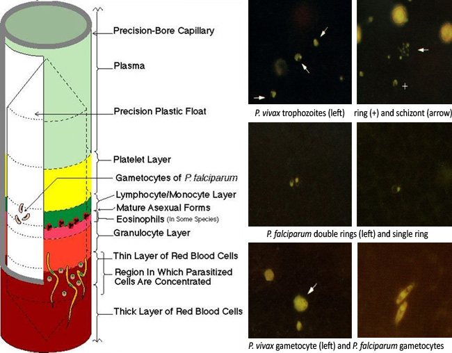 Microscopic Tests Malaria Site