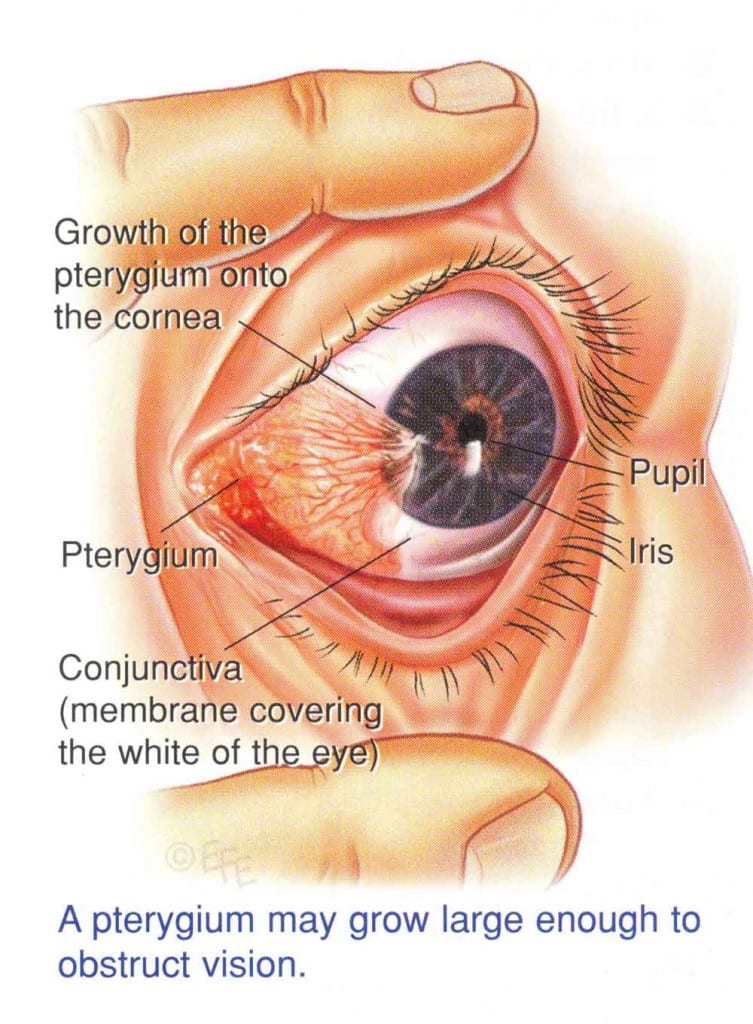 Photochromatic Lenses Optometrist in Petaling Jaya Optical Shop Promotion Malaya Optical
