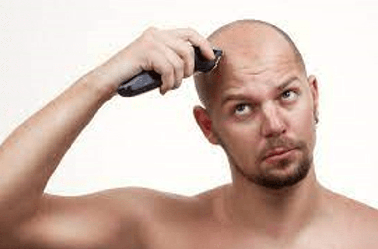 The Complete Guide On The Best Head Shavers For Men