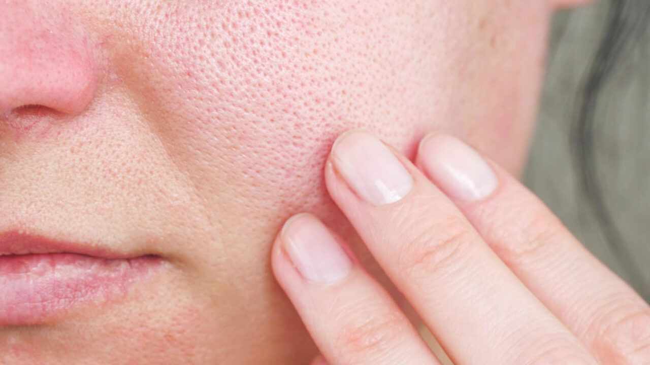Clogged pores? Unclog pores on your face in 6 steps mamabella