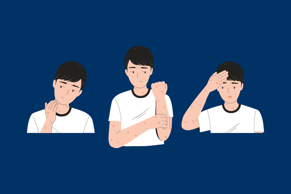 Monkeypox Medical Associates of Northwest Arkansas