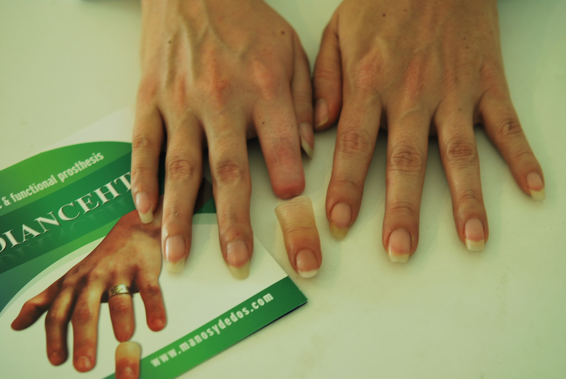 Silicone Left Hand Fingertip Protector Mark Wein Guitar Lessons