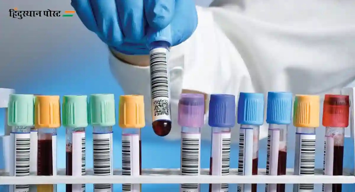 Medical laboratory technician salary भारतात लॅब टेक्निशियनचा पगार