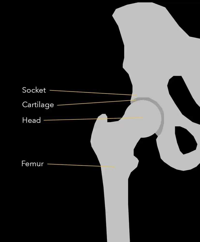 Hip Pain Joseph Maratt, MD