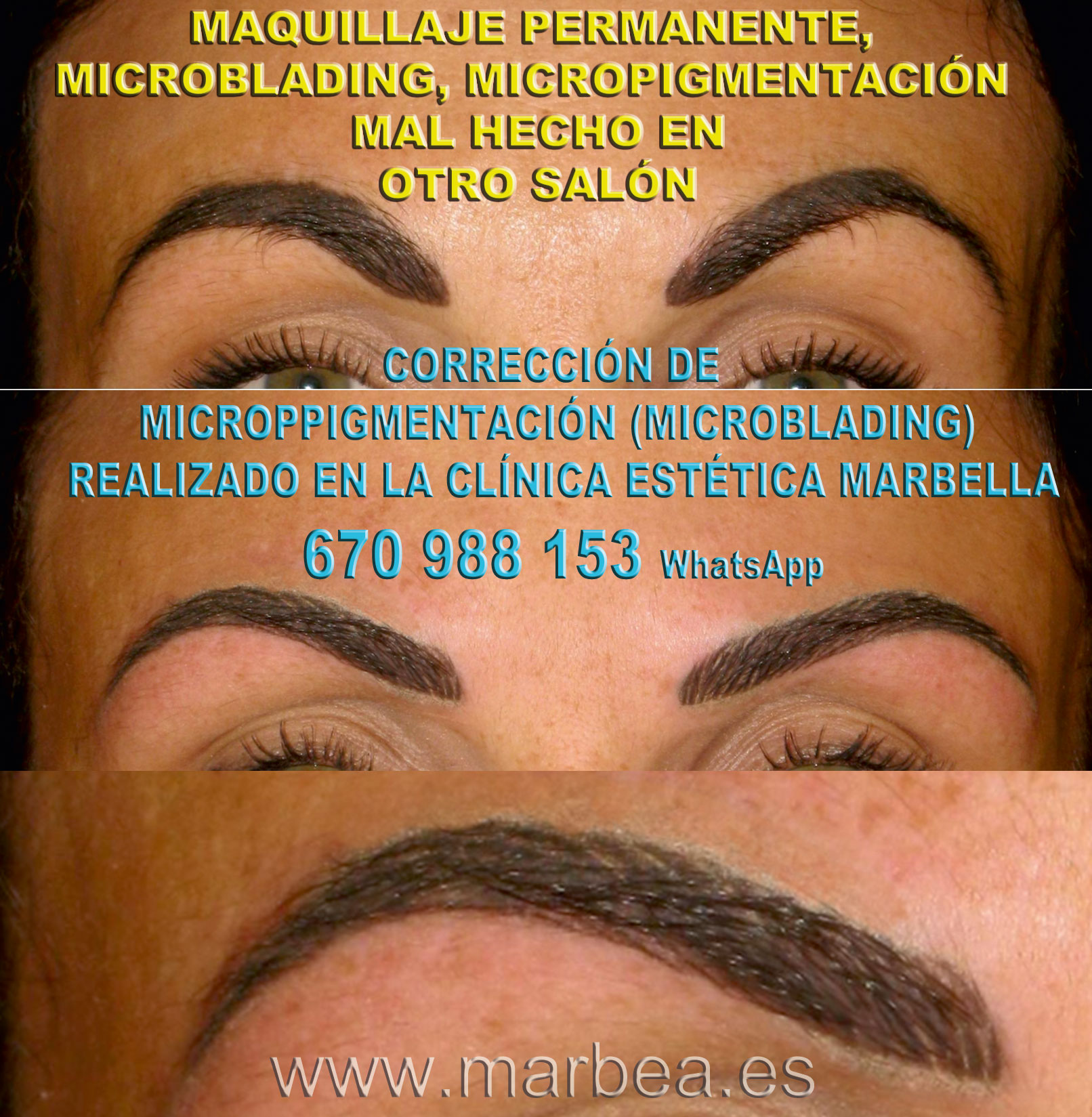 Borrar maquillaje permanente mal hecha clínica estética tatuaje ofrece micropigmentacion correctiva de cejas,corregir micropigmentación mal hecha