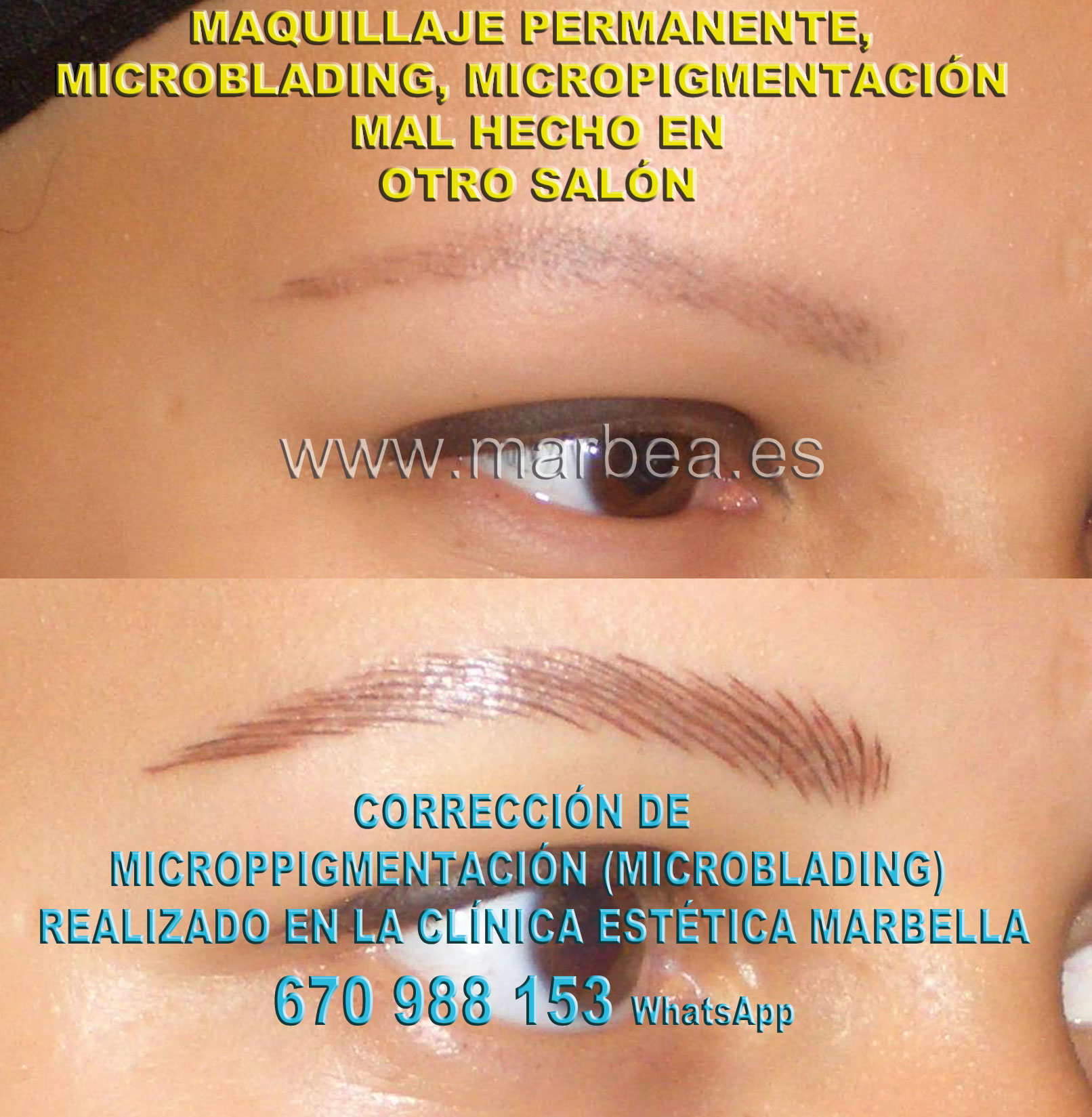 Borrar maquillaje permanente mal hecha clínica estética maquillaje semipermanente propone micropigmentacion correctiva de cejas,corregir micropigmentación no deseada