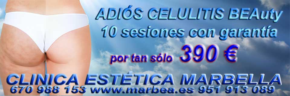 rejuvenecimiento facial Algeciras quitar para quitar arrugas ojos sin cirugia en Marbella o Algeciras