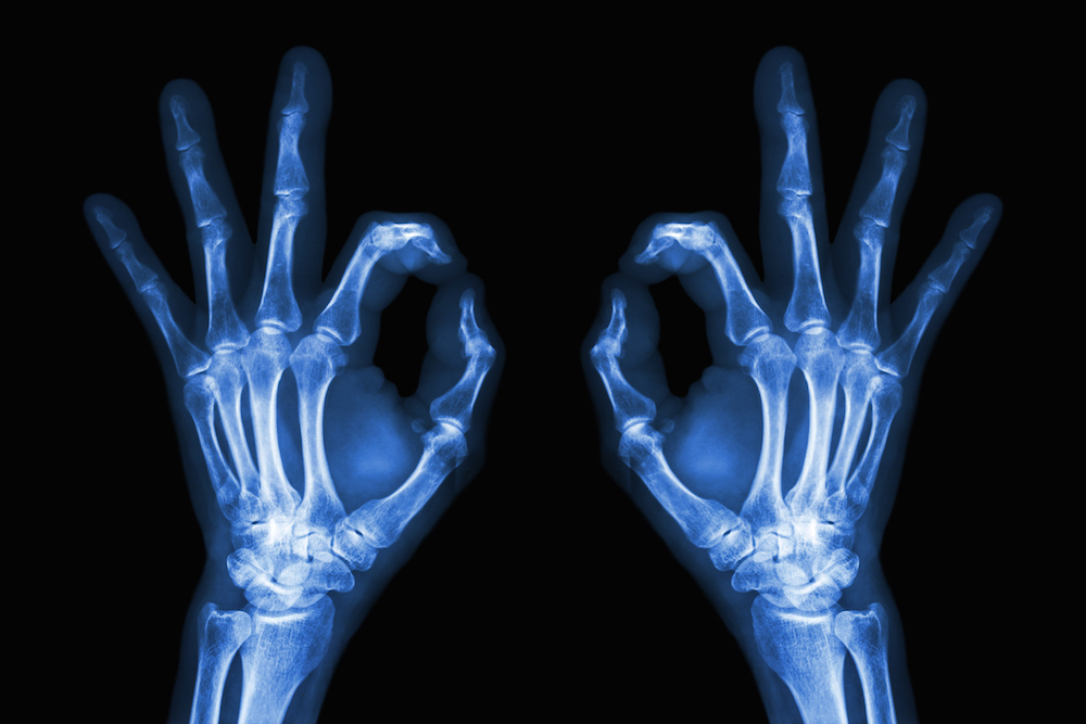 How to Xray a network martingeddes