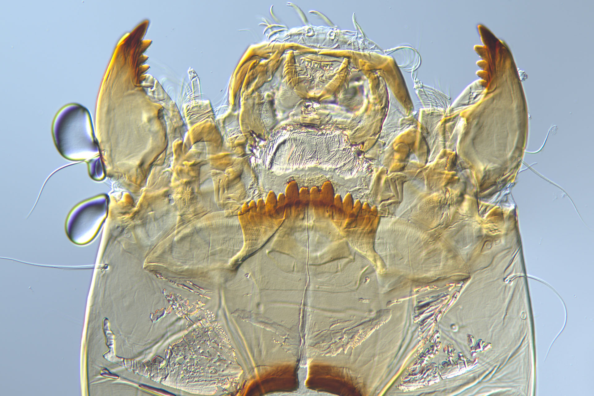 Differential Interference Contrast Martin Microscope