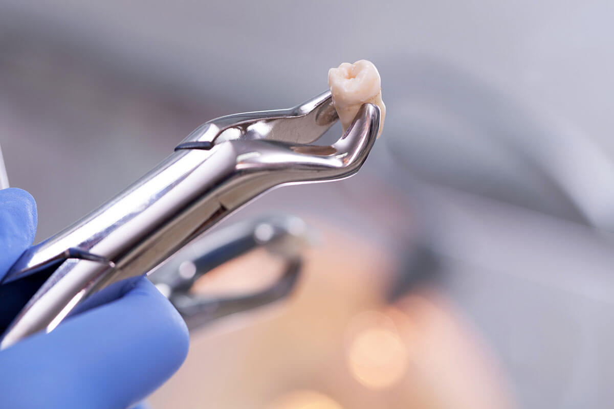 Extractions Merrimack Valley Oral Surgeons, Inc