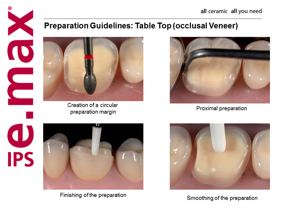 McDowell and Service Crown and Bridge McDowell