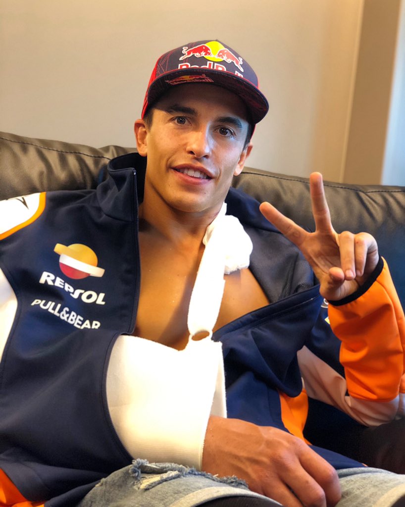 Select from premium marc marquez of the highest quality. Marc Marquez breaks arm | | Motorcycle News, Sport and Reviews