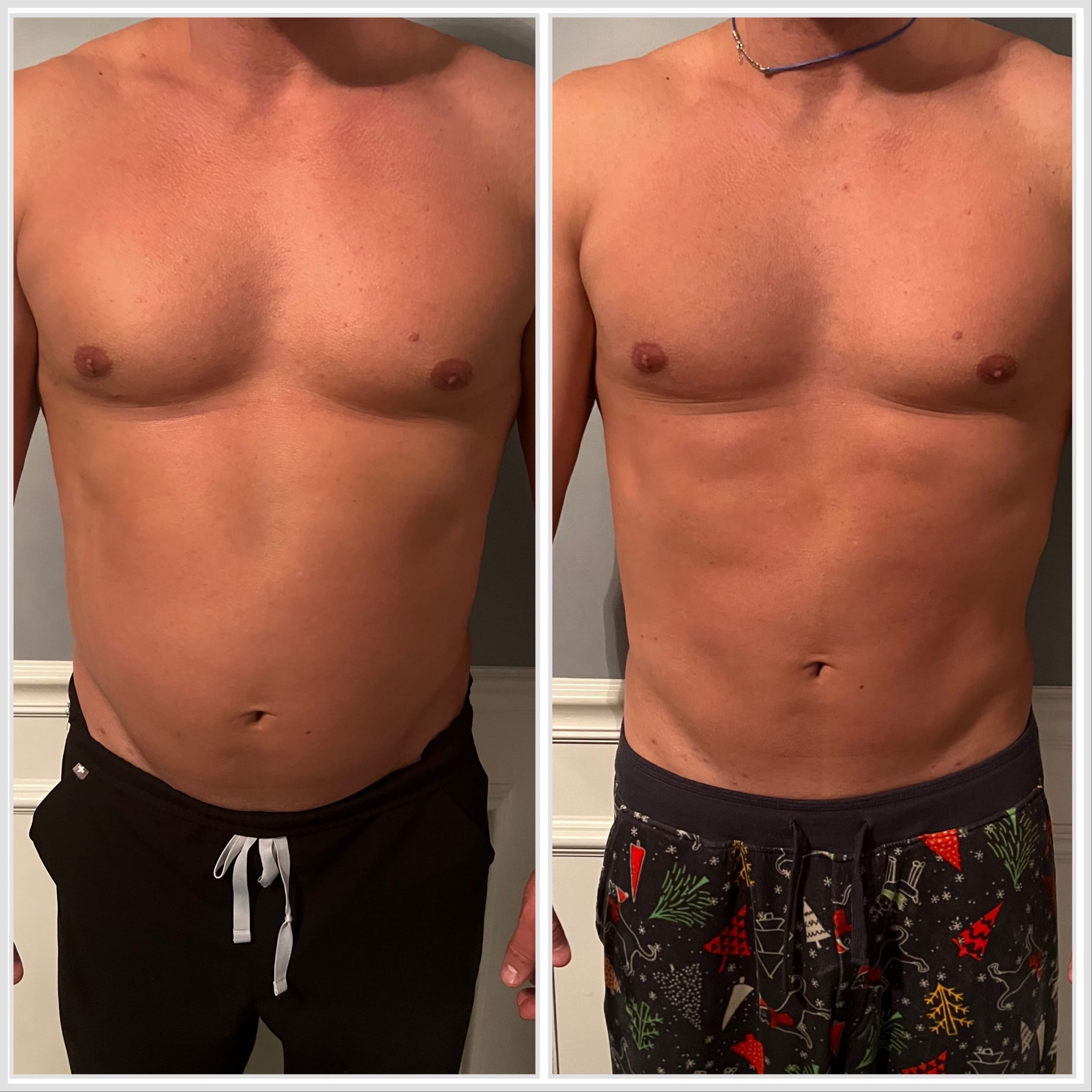 Semaglutide for Weight Loss MD Esthetics