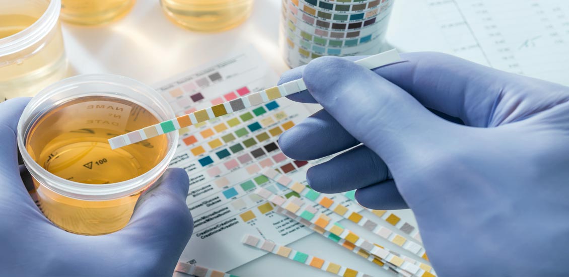 EXAME DE URINA Leucócitos, Nitritos, Hemoglobina... MD.Saúde