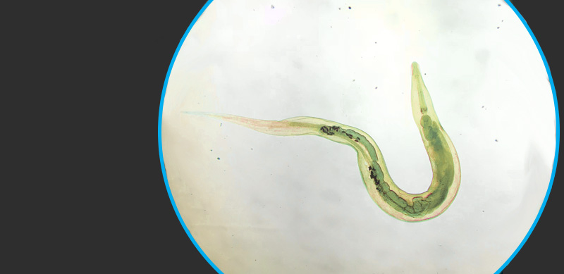 OXIURÍASE Infecção pelo Enterobius vermicularis • MD.Saúde
