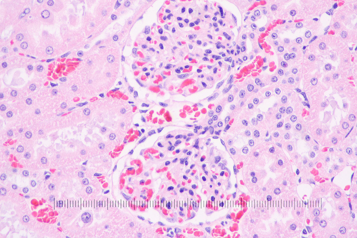 Microscope Adapter Trinocular Port Attachment