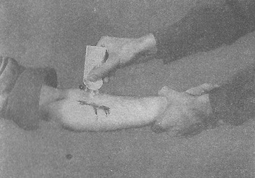 Class 9 Items: Drugs, Chemicals And Biological Stains Sulfa Drugs | Ww2 Us Medical Research Centre