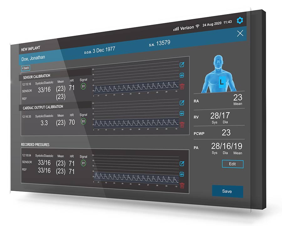Project Snapshot UI Development Using Qt (QML) MedAcuity Software