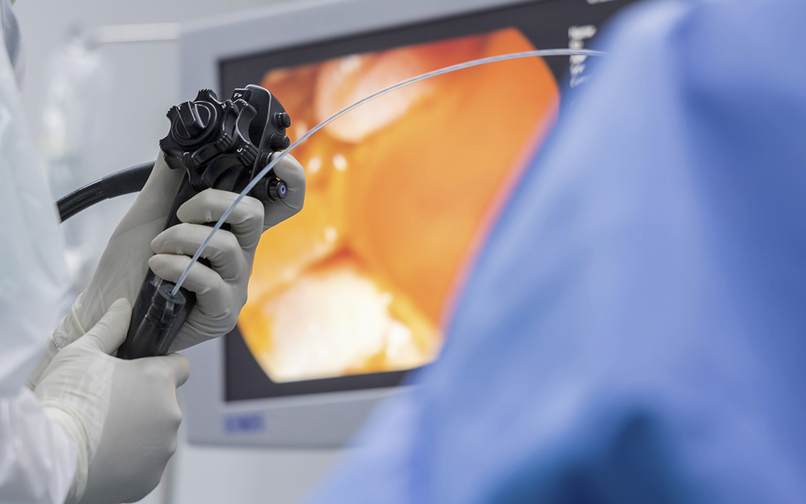 The Endoscopy Solution Medi Projects