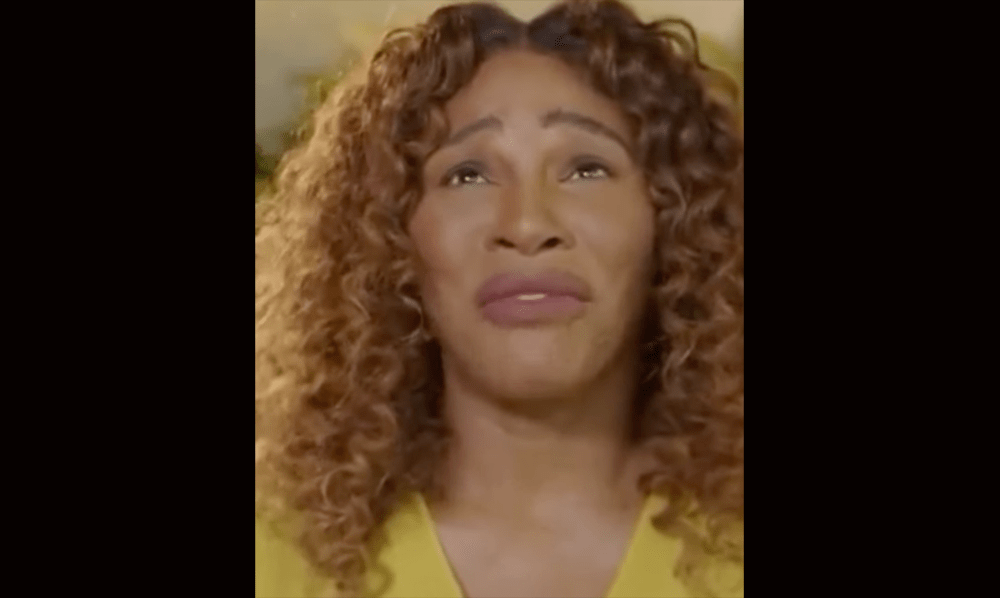 Fans Say Serena Williams DESTROYED Her Face w/ BOTCHED Surgery