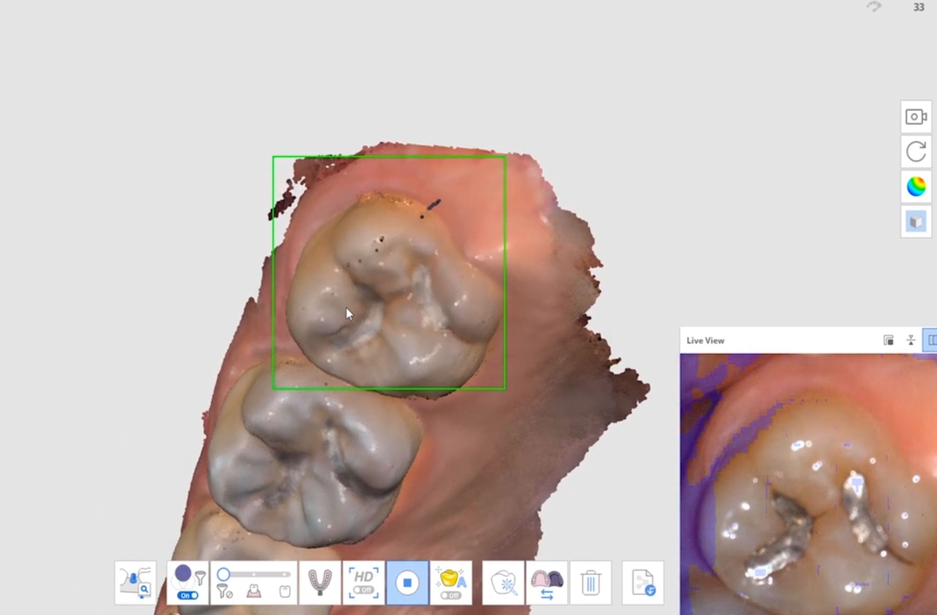 Medit i700 Intraoral Scanner RIS MEDIC EQUIPMENTS