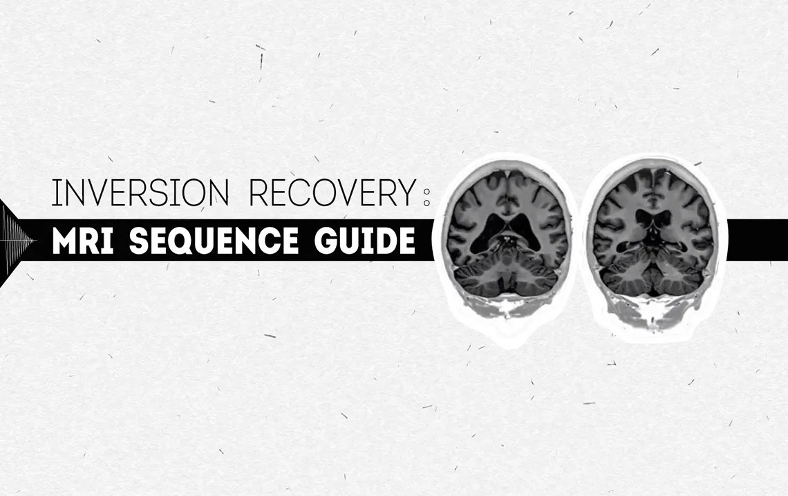 Inversion Recovery MRI Sequence Guide Medical Professionals