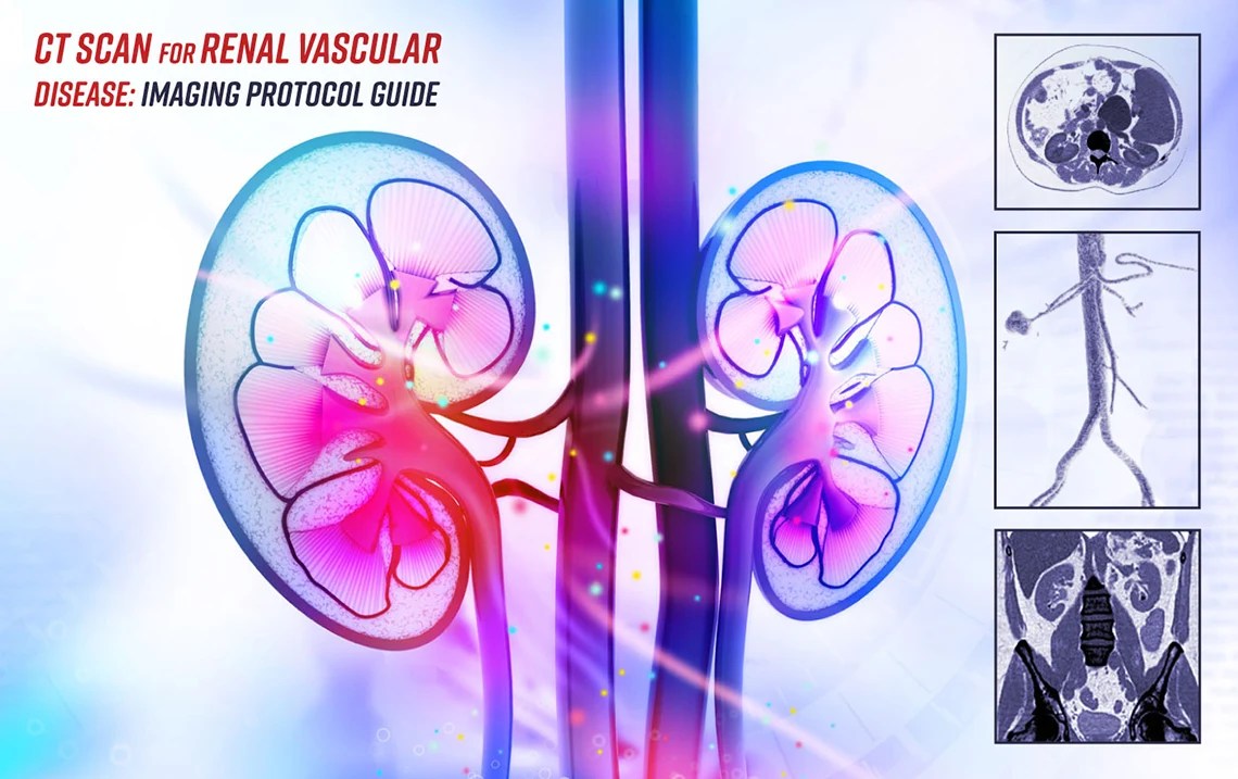 Renal CT Scan for Vascular Diseases A Complete Imaging Guide