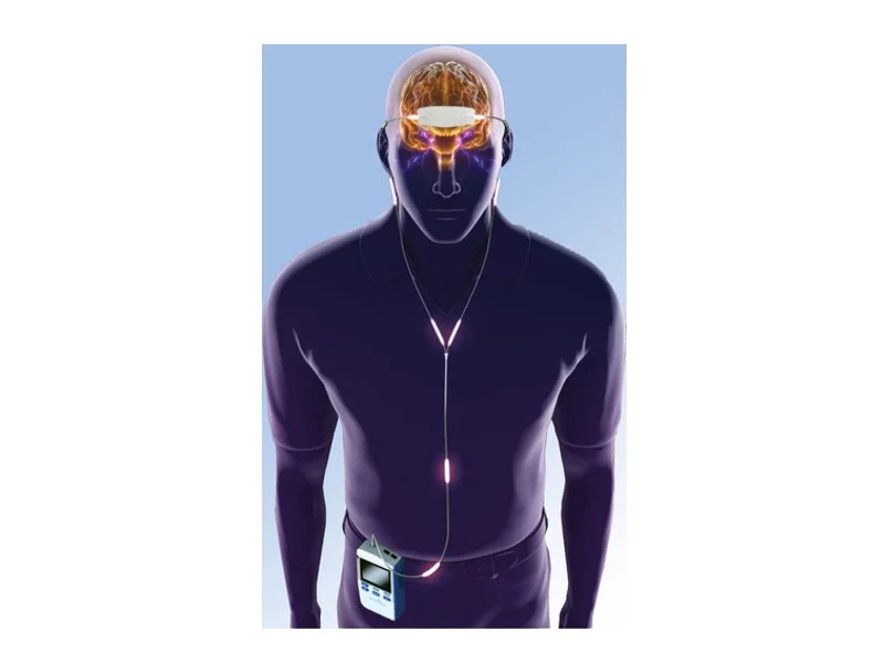 Monarch eTNS System, US