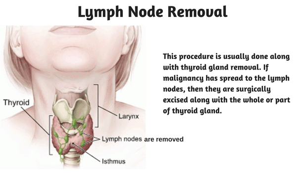 Thyroid Cancer Surgery Procedure, Risks and Associated