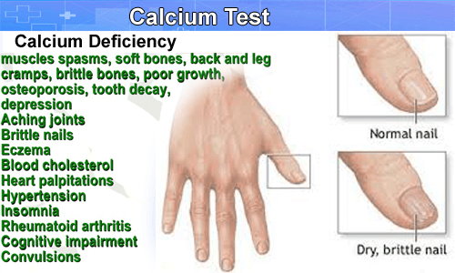 Book Calcium Test Online at 30 Discount