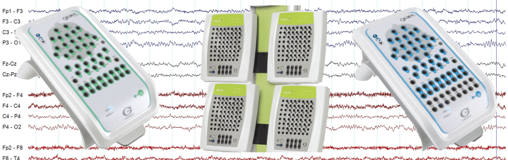 Elektroencefalografia Eeg Portal Fizjoterapeuty Mobile Legends