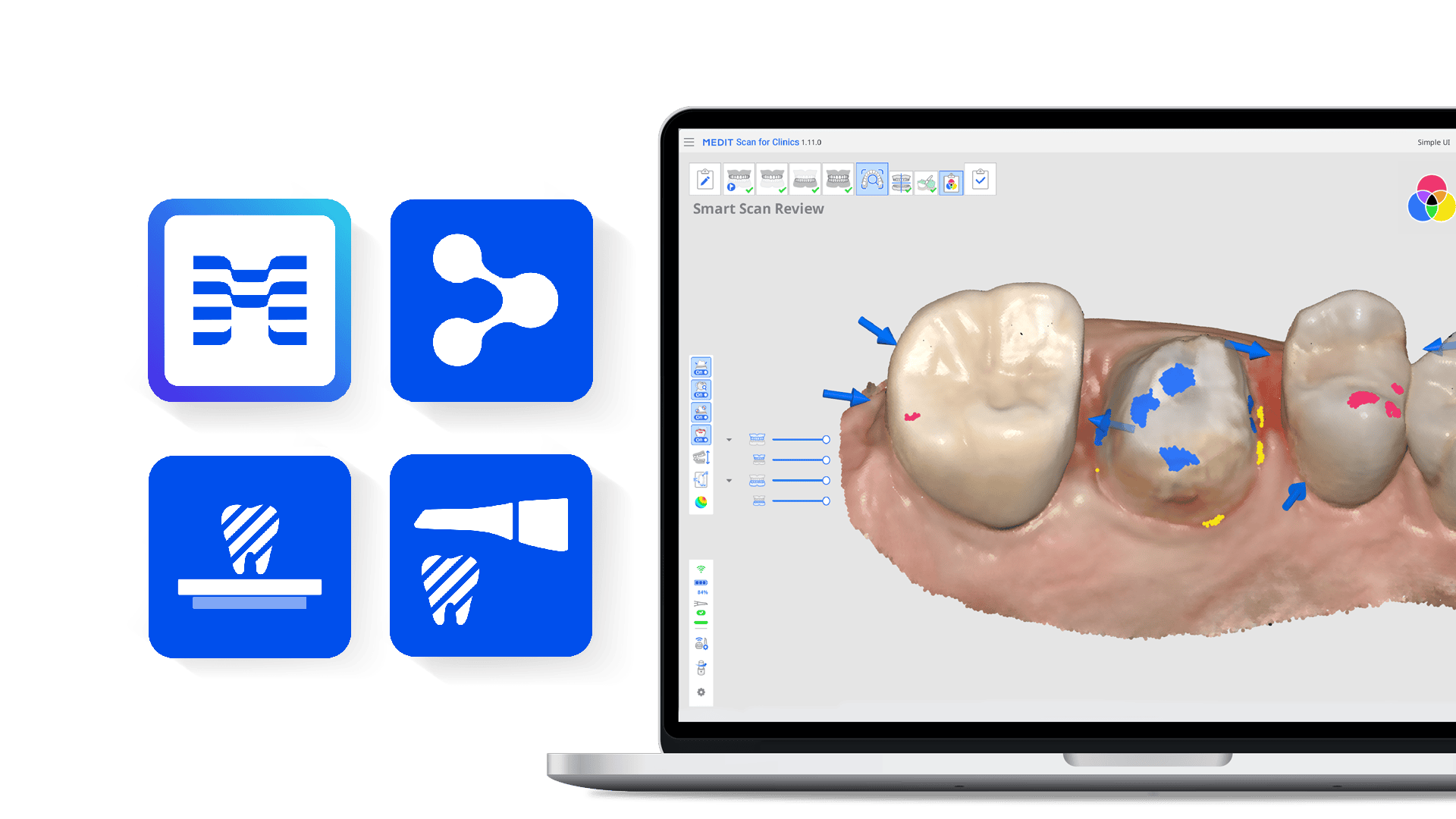 Medit Smile Design Intraoral Scanners and Dental Software