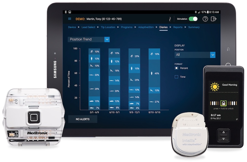 Medtronic Spinal Cord Stimulator Manual
