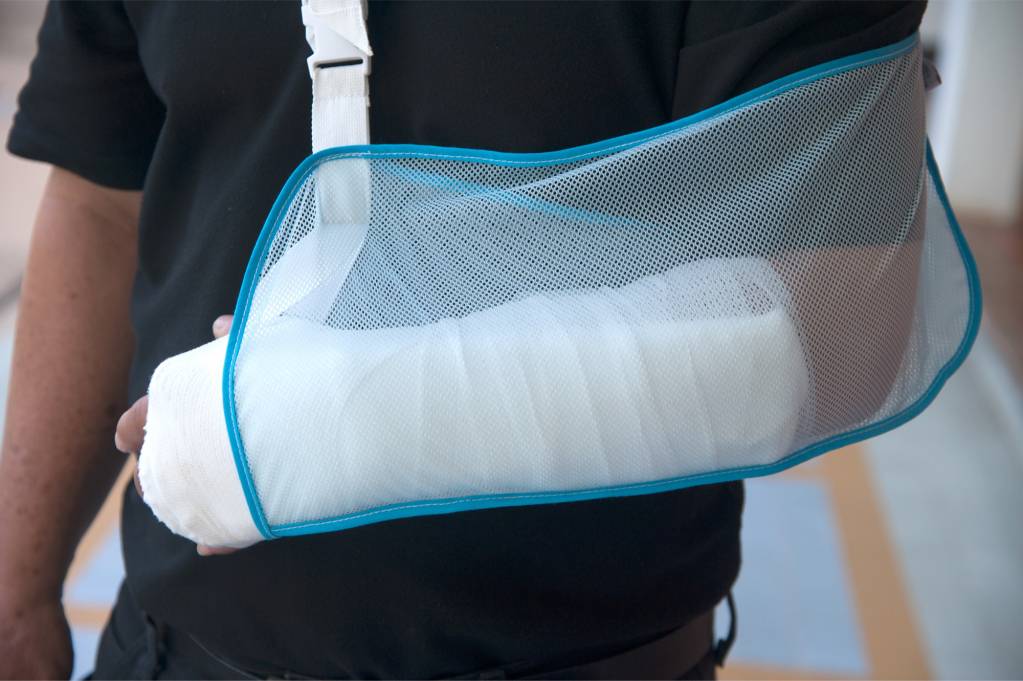 Armbruch (gebrochener Arm) » Oberarmbruch, Unterarmbruch