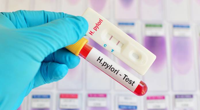 Welche Tests auf Helicobacter pylori können durchgeführt werden?