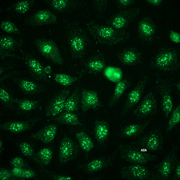 Opinions on Anticentromere antibodies