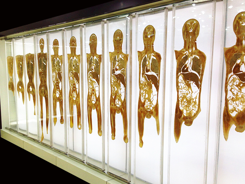 Coronal section of slices of the whole body transparent slice, embedded