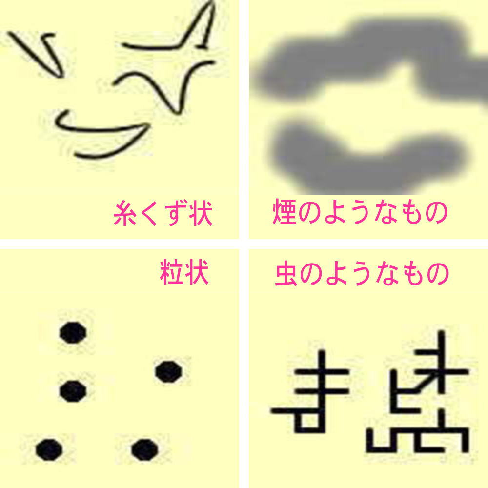 飛蚊症 目の病気と症状