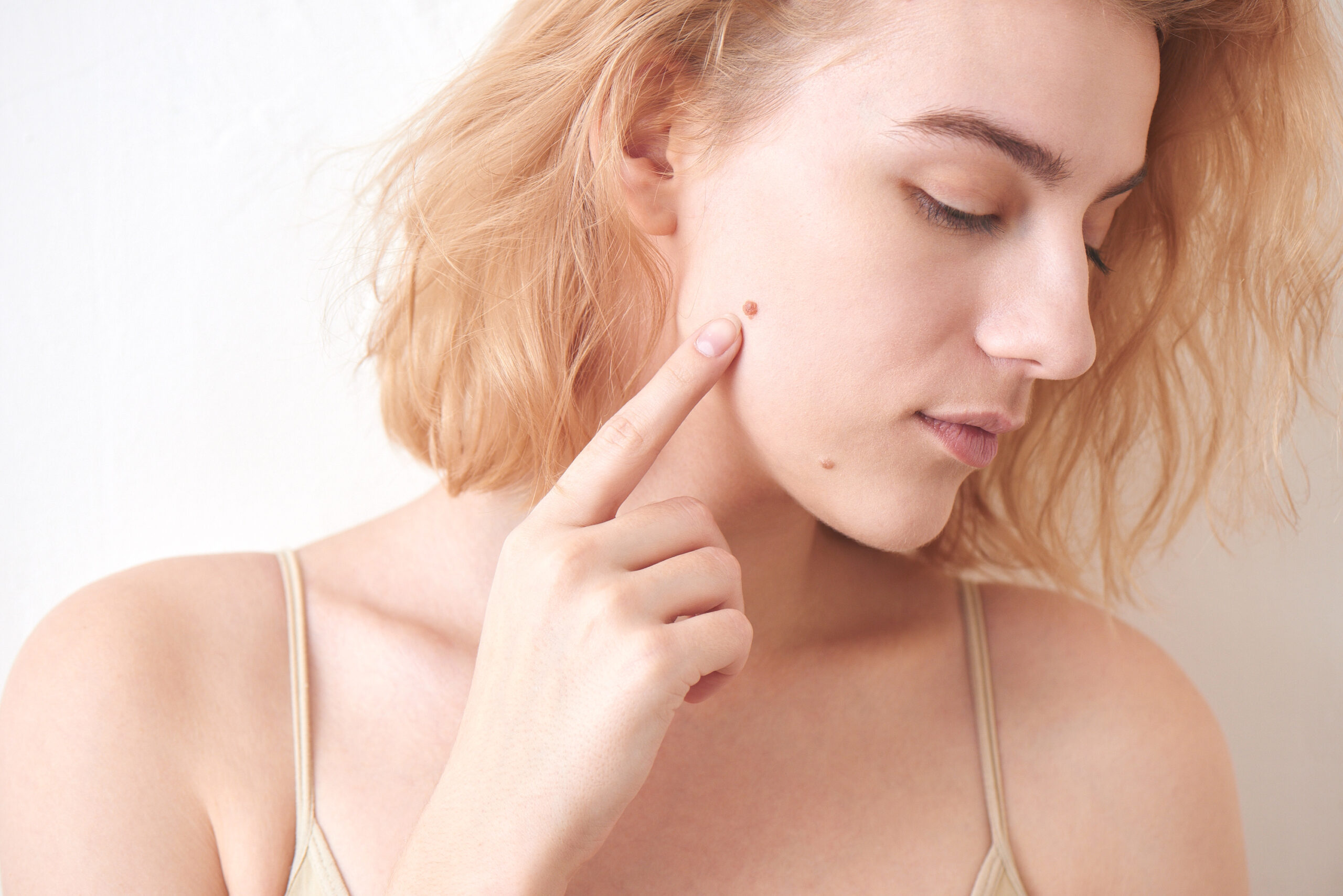 Why Do You Get Skin Moles and Beauty Marks? Metrin Skincare