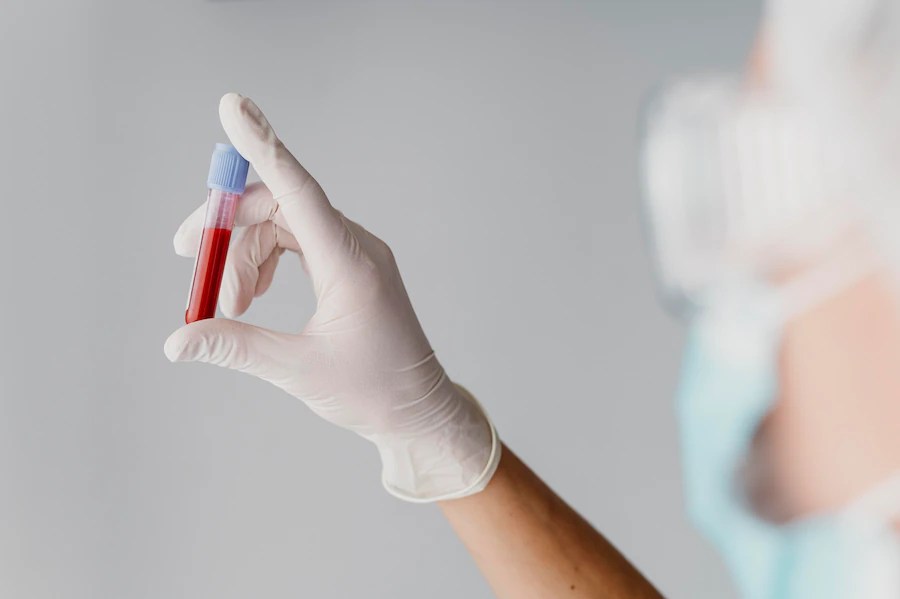 ELISA Test For HIV Purpose, Procedure and Results
