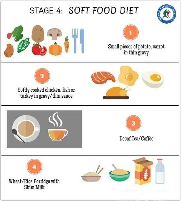 Gastric Sleeve PostOp Diet Tips That Work