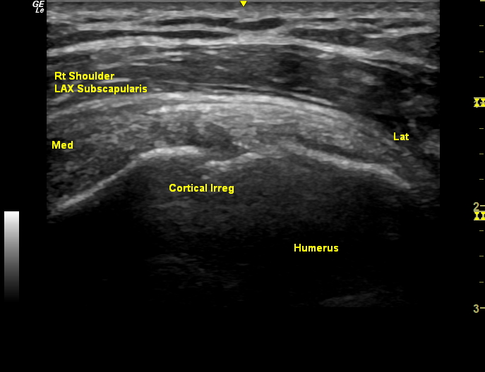 MSK Diagnostic Ultrasound Scans performed in Clinic